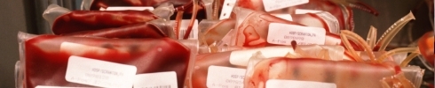 Blood Bank Fridges